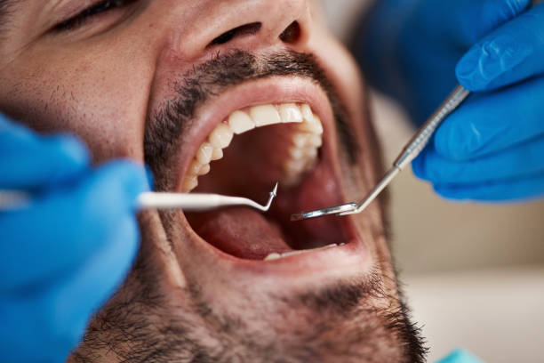 Best Emergency Treatment for Dental Infections or Abscesses in Montgomeryville, PA